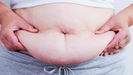 Obesity - Fat Belly